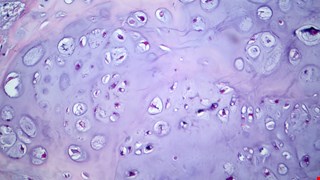NAMPT enhances LOX expression and promotes metastasis in human chondrosarcoma cells by inhibiting miR-26b-5p synthesis img
