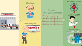 Implementation of an All-Day Artificial Intelligence-Based Triage System to Accelerate Door-to-Balloon Times img