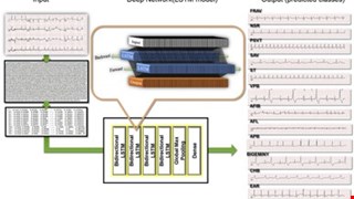 Usefulness of Machine Learning Based Detection and Classification of Cardiac Arrhythmias with 12 Lead Electrocardiograms img